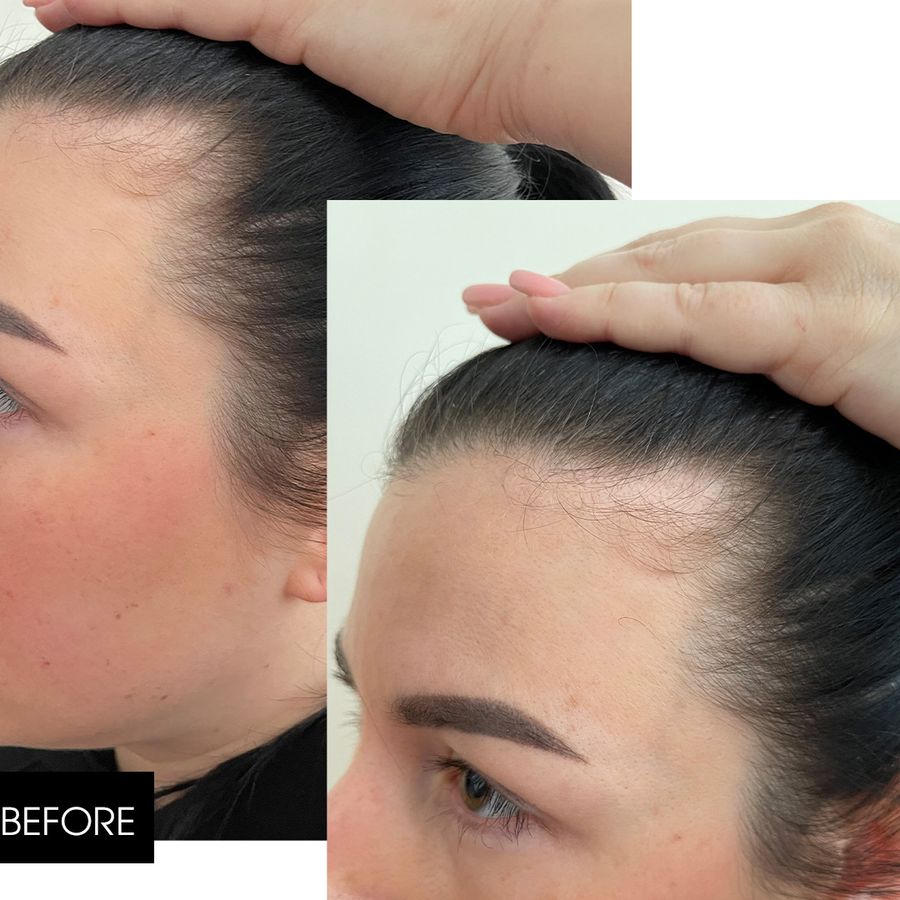 Шампунь проти випадіння волосся Hillary Serenoa & РР Hair Loss Control Shampoo, 250 мл - фото №1