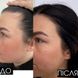 Шампунь и сыворотка для волос Concentrate Serenoa + кондиционер против выпадения волос - фото