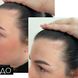 Шампунь та сироватка для волосся Concentrate Serenoa + кондиціонер проти випадіння волосся - фото