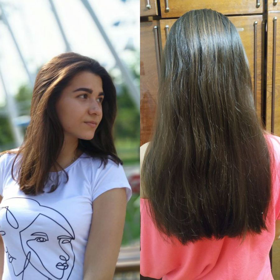 Мезороллер для шкіри голови + Комплекс для росту волосся Hop Cones & B5 Hair Growth Invigorating - фото №1
