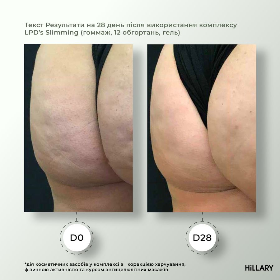 Жидкость для антицеллюлитных липосомальных обертываний Hillary Anti-cellulite Bandage LPD'S Slimming Fluid - фото №1