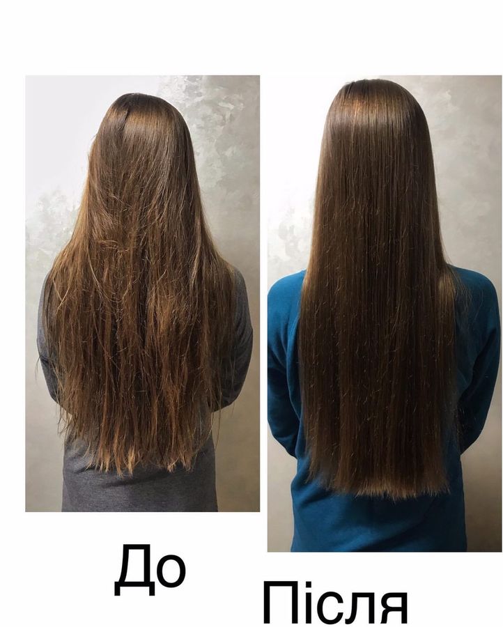 Набор комплексного ухода за жирным типом волос Hillary Perfect Hair Green Tea - фото №1