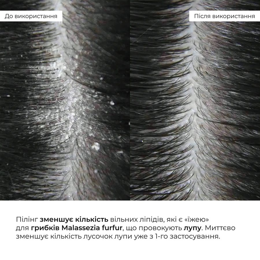 Энзимный трихологический пилинг для кожи головы Hillary Enzyme Trichological Scalp Peel, 120 мл - фото №1