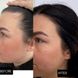 Маска проти випадіння волосся Hillary Serenoa & РР Hair Loss Control Mask, 200 мл - фото