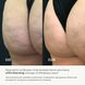 Антицеллюлитный липосомальный гель Hillary Anti-cellulite Gel LPD's Slimming, 200 мл - фото